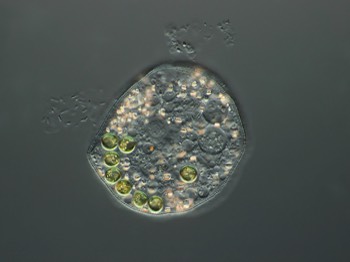  Cochliopodium with nucleus, food vacuoles, symbiotic algae and crystals 