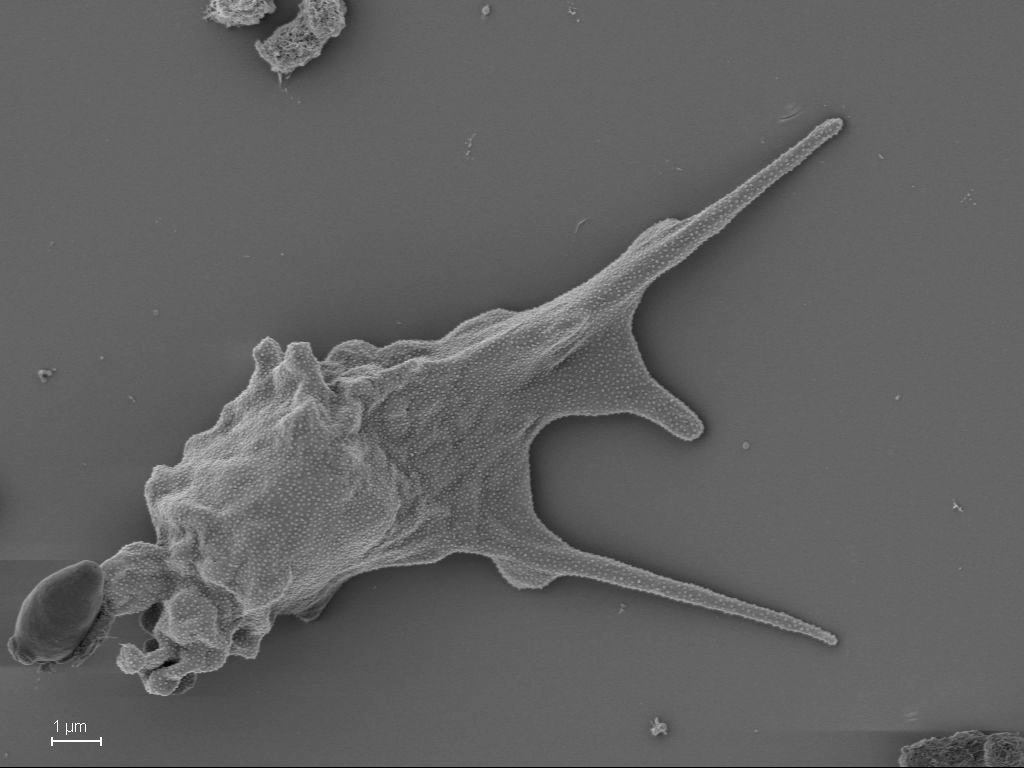  Pseudoparamoeba microlepis 