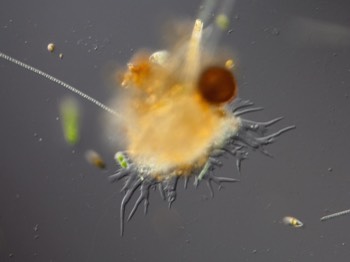  Leptomyxid amoeba 