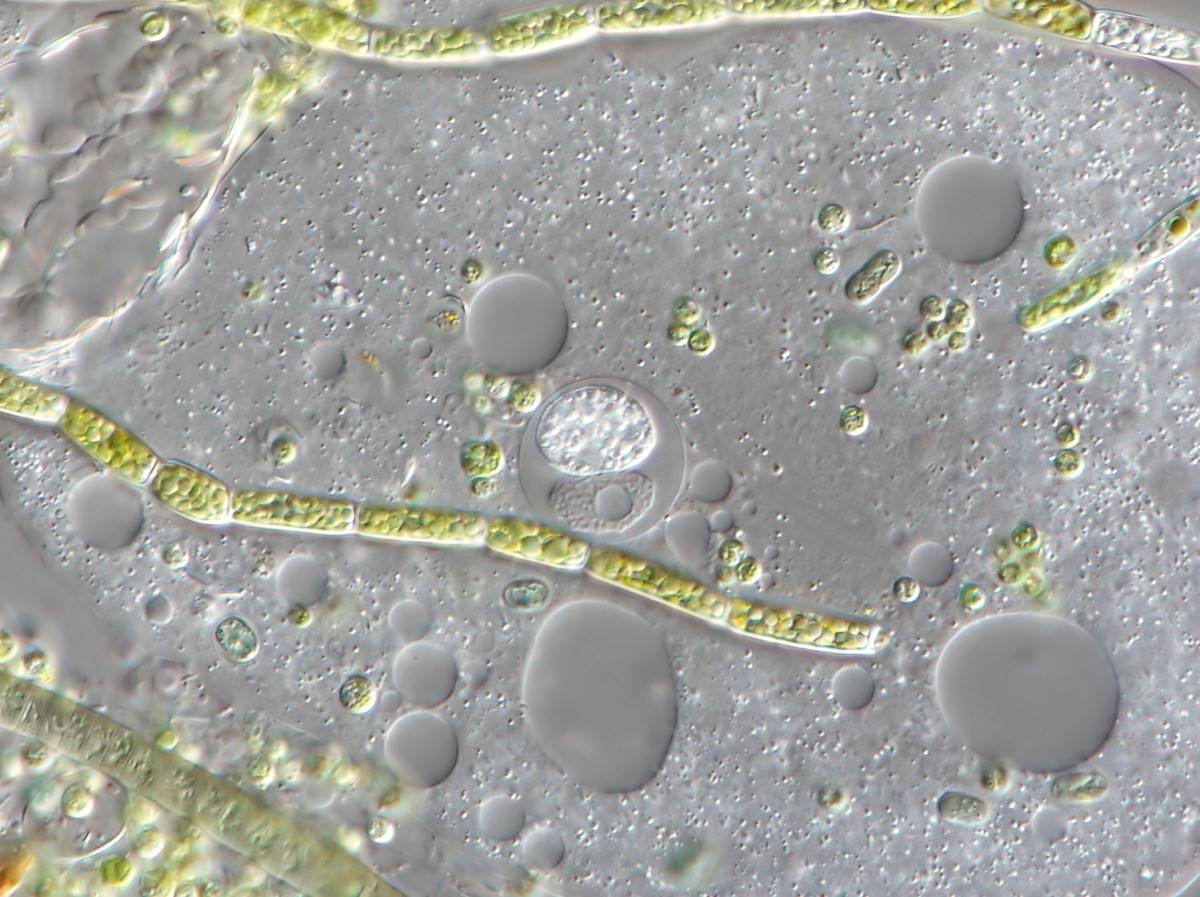 Nucleophaga amoebae 1